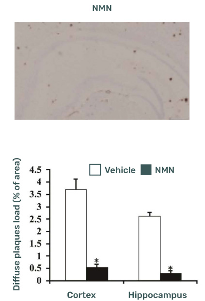 NMN Effects on Diabetes